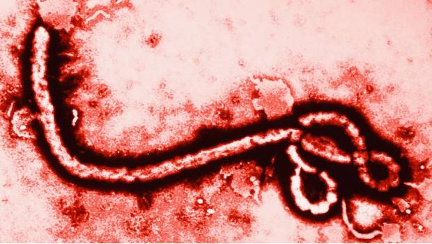 Supervivientes del Ébola inmunes 40 años después. Noticias en tiempo real