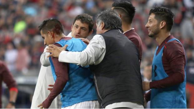 Jugador del Toluca, descalabrado tras recibir golpe con objeto lanzado desde la tribuna. Noticias en tiempo real