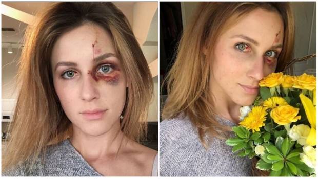 Campeón de motocross propina brutal golpiza a su novia por publicar una foto en Instagram. Noticias en tiempo real